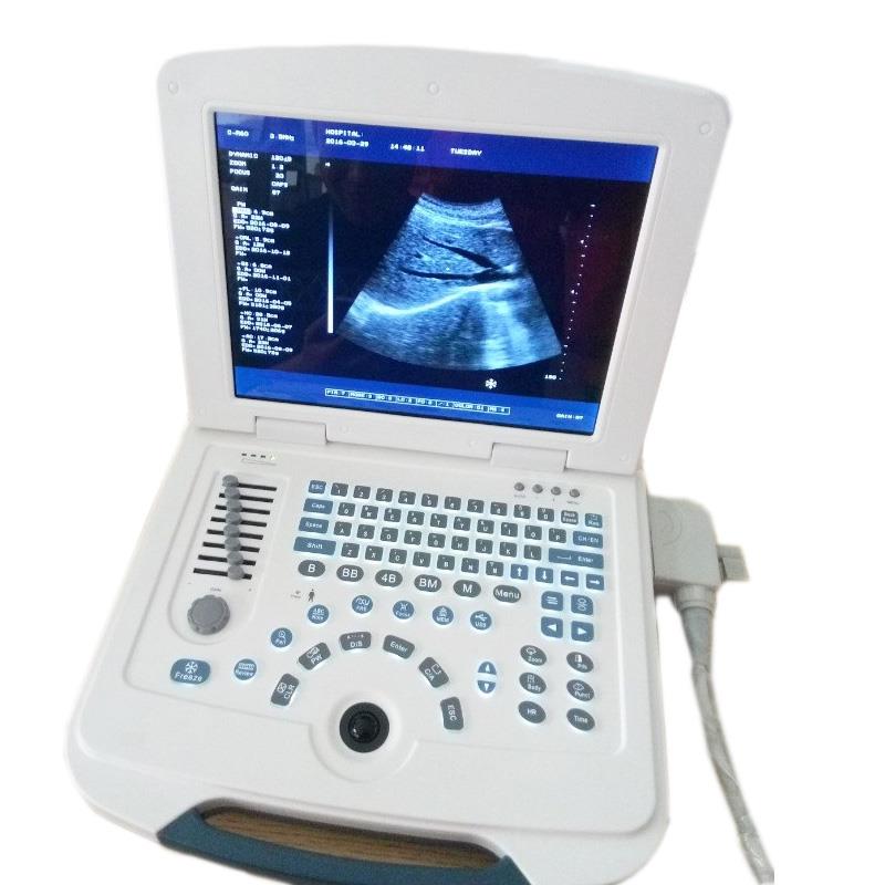 Portable Ultrasound Machine