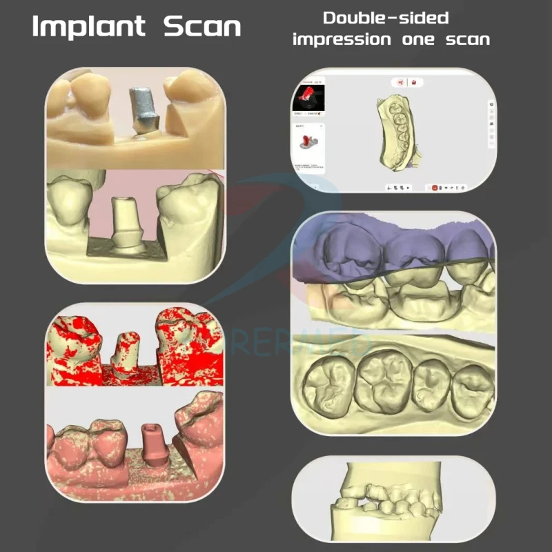 Desktop Scanner Dental Desktop Scanner Dental