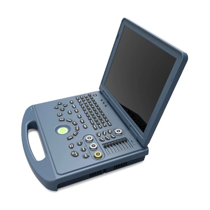 15'' LED Notebook Color Ultrasound Scanner