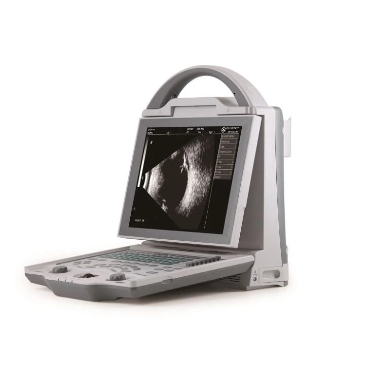 АБ офталмички ултразвучни скенер