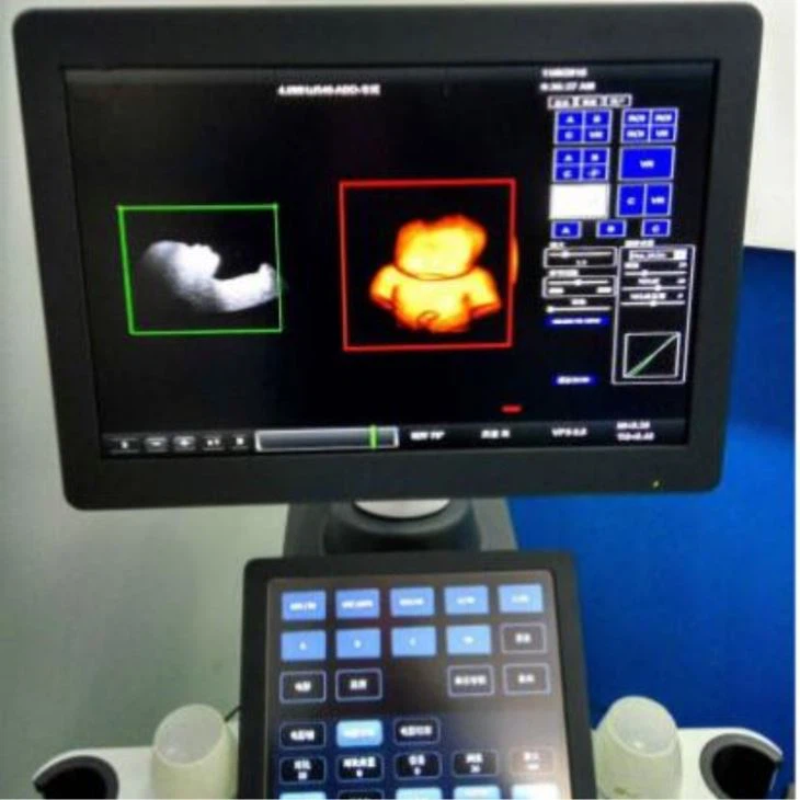 Laptop Color Doppler Ultrasound Scanner