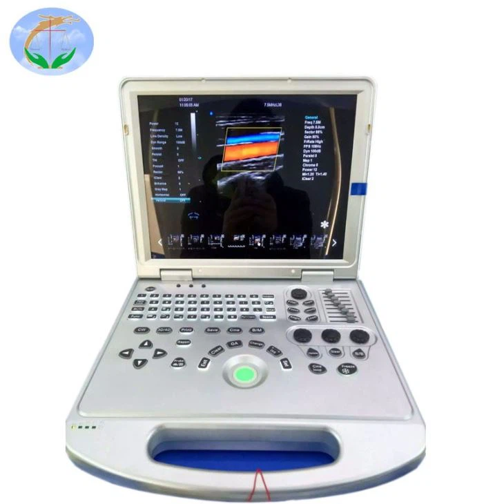 4D Trolley Full Digital Scanner