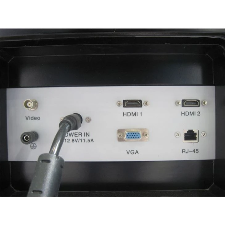 Ultrasound Diagnostic Machine With Elastography