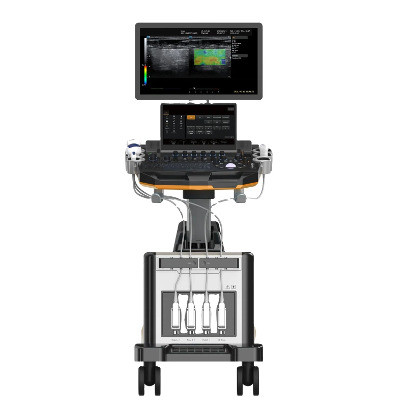 Ехосонограф срца