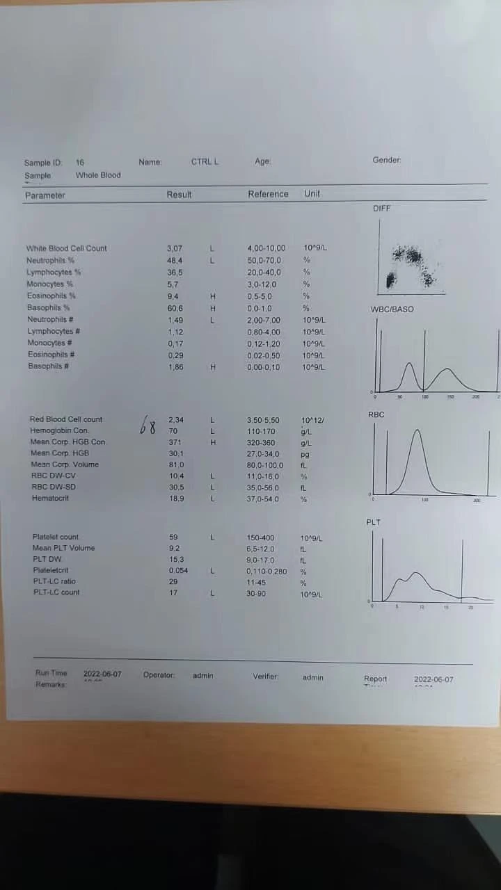 cheap hematology analyzer made in china